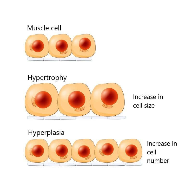 muscle cells